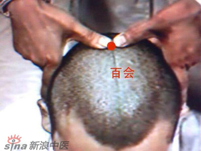 艾灸常用的保健穴有哪些？--百會