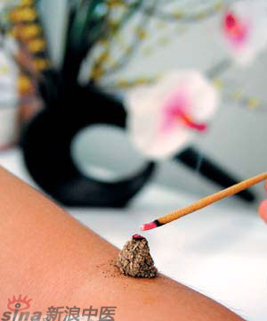 節(jié)氣灸” 冬至，你灸了嗎？
